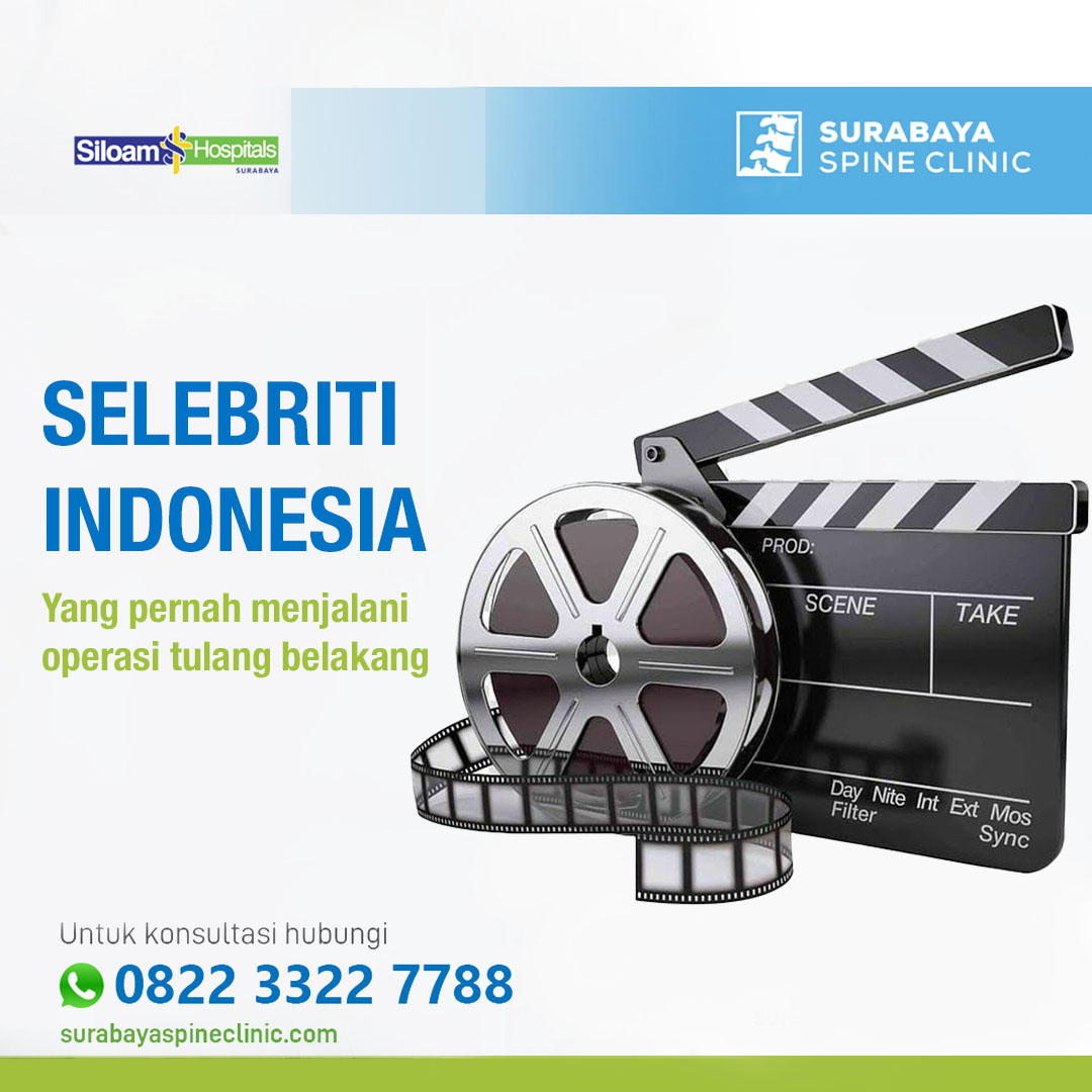 10 Selebriti Indonesia Yang Pernah Menjalani Operasi Tulang Belakang 